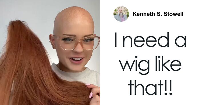 “You Have To Be Kidding Me”: Makeup Artist With Alopecia Goes Viral With Stunning Transformations