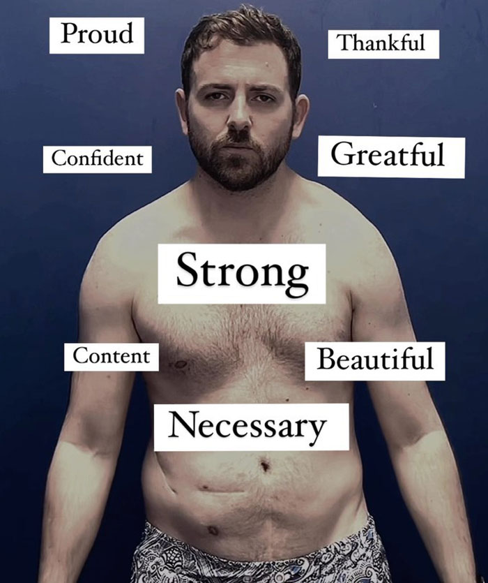 "Ashamed And Embarrassed": Man Without An Anus Reveals His Peculiar Bowel Habits