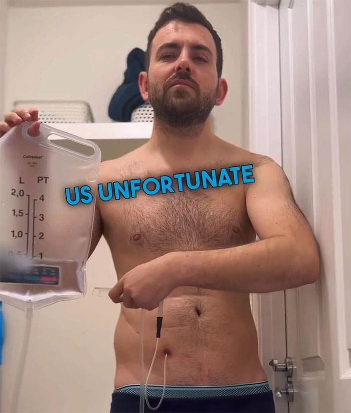 "Ashamed And Embarrassed": Man Without An Anus Reveals His Peculiar Bowel Habits