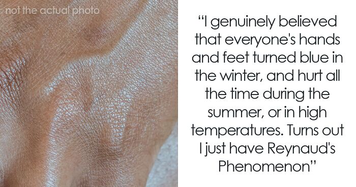 “Lived Like This Until 21”: 50 Times People Found Out Their Bodies Were Different From The ‘Norm’