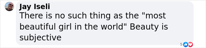 "I Feel Sorry For Her": People React To New Photos Of World's "Most Beautiful Girl" "I Feel Sorry For Her": People React To New Photos Of World's "Most Beautiful Girl"