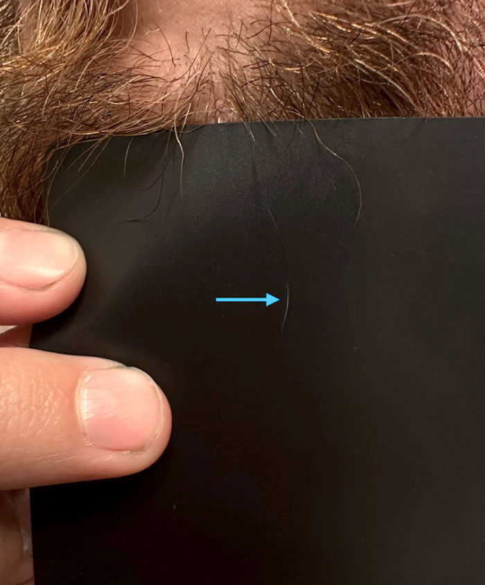 This Beard Hair Used To Be Gray Before I Started Taking Medication For My Anxiety