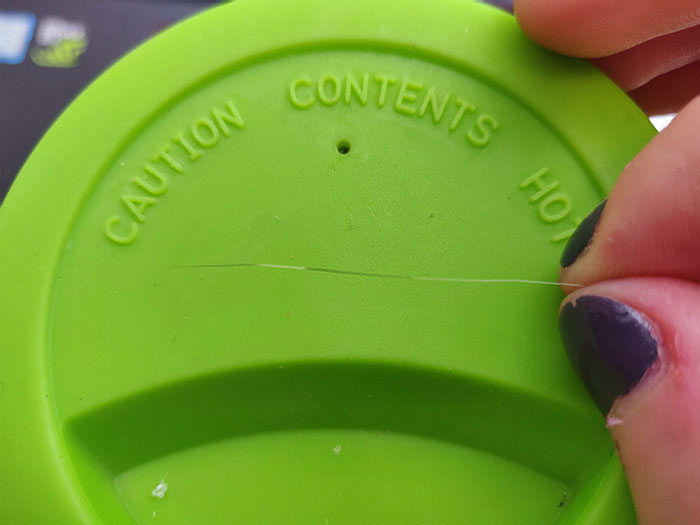 My Friends Medication Makes Some Of His Hair Grow White While He's Taking It, So His Hair Becomes Stripey Over Time As He Goes On And Off The Medication