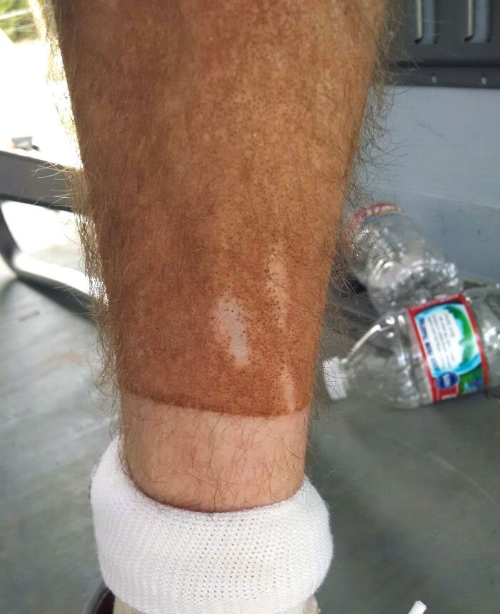 I Went Four Wheeling And The Dirt Stuck To My Leg Everywhere But Where I Have Scars