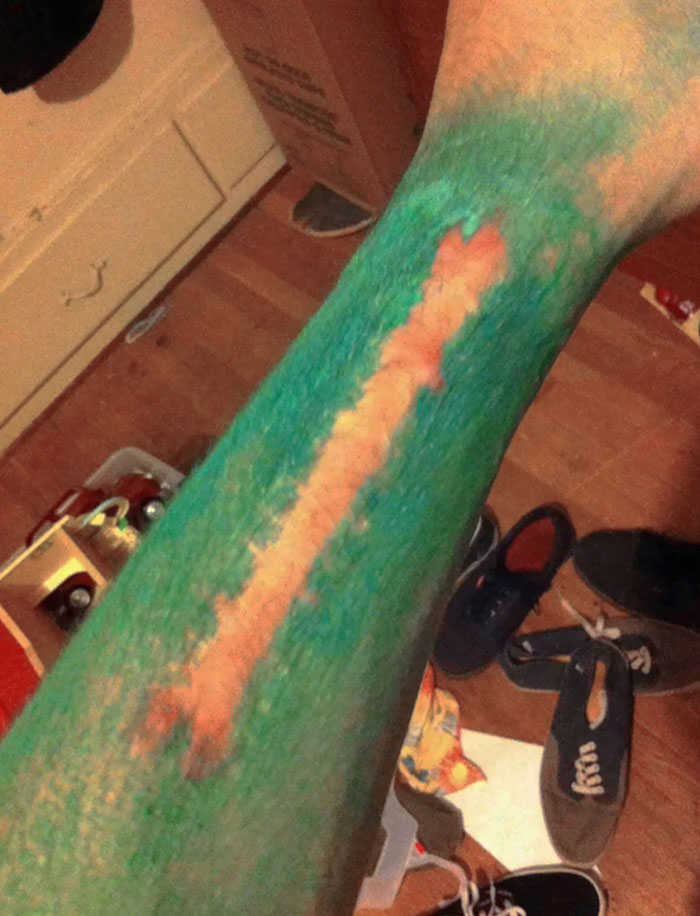So I Recently Went On A Color Run And My Scar Repelled The Dye