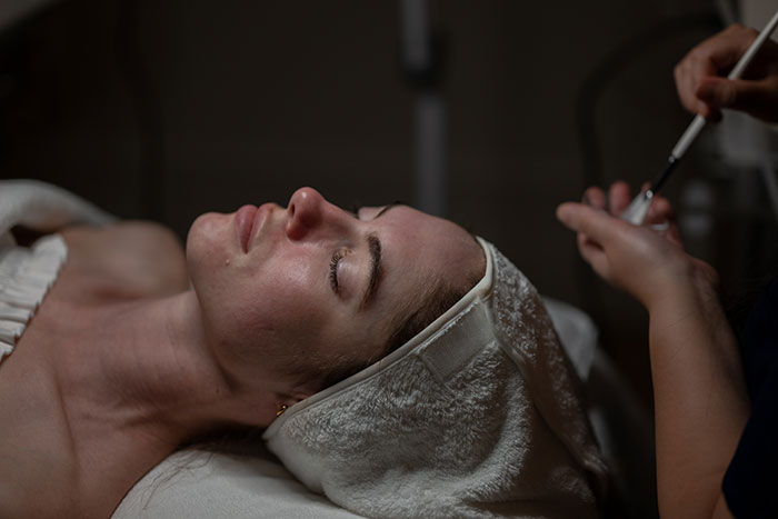 Amid Viral Injuries, Skin Expert Exposes Dangers Of Botched Microneedling Treatments (Exclusive)