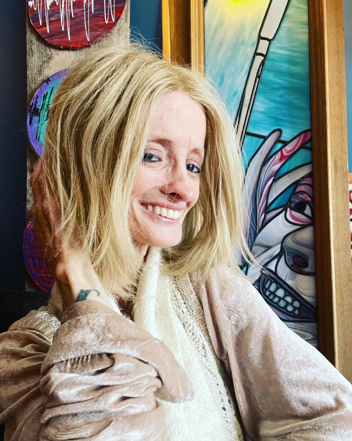 &ldquo;Right Now Is All We Have&rdquo;: Woman With Rare &lsquo;Benjamin Button&rsquo; Condition Claps Back At Trolls