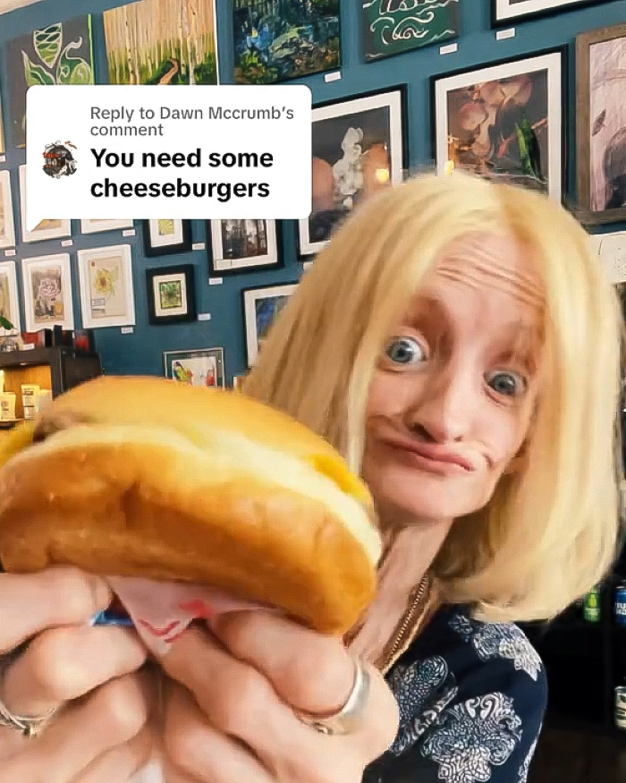 &ldquo;Right Now Is All We Have&rdquo;: Woman With Rare &lsquo;Benjamin Button&rsquo; Condition Claps Back At Trolls