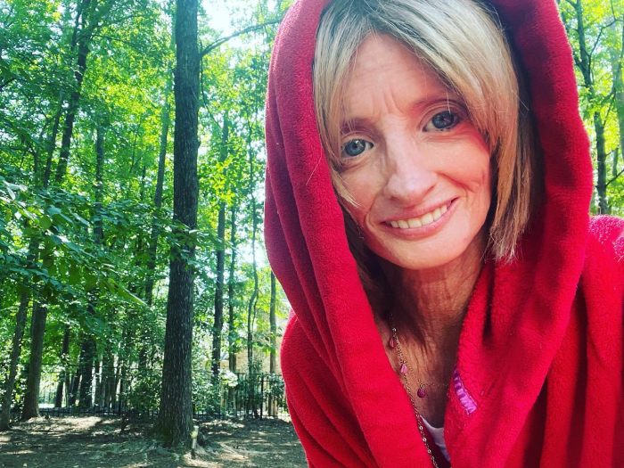 &ldquo;Right Now Is All We Have&rdquo;: Woman With Rare &lsquo;Benjamin Button&rsquo; Condition Claps Back At Trolls