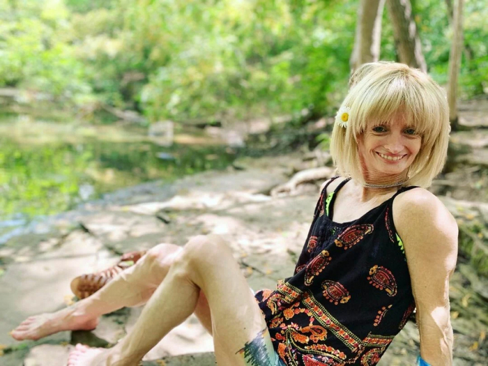 &ldquo;Right Now Is All We Have&rdquo;: Woman With Rare &lsquo;Benjamin Button&rsquo; Condition Claps Back At Trolls