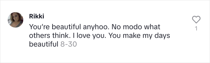 &ldquo;Right Now Is All We Have&rdquo;: Woman With Rare &lsquo;Benjamin Button&rsquo; Condition Claps Back At Trolls