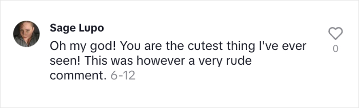 &ldquo;Right Now Is All We Have&rdquo;: Woman With Rare &lsquo;Benjamin Button&rsquo; Condition Claps Back At Trolls