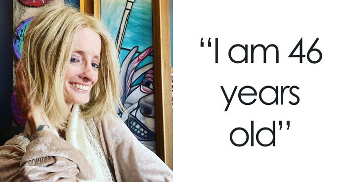 “Right Now Is All We Have”: Woman With Rare ‘Benjamin Button’ Condition Claps Back At Trolls