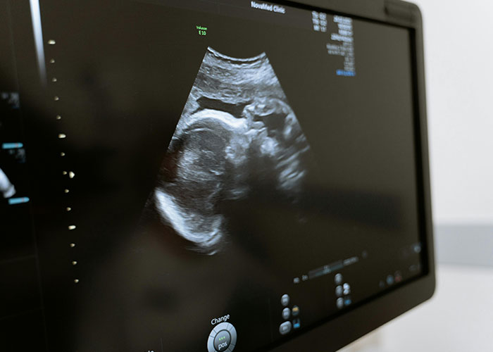 “It Still Hurts”: 50 Experiences That Broke People’s Hearts Into A Million Pieces