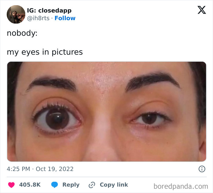 Close-up of eyes humorously illustrating uneven expressions, reflecting funny posts' spot-on observations.