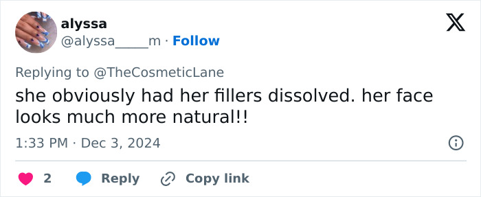 Tweet about Donatella Versace&rsquo;s new face, with a comment on a natural look after dissolving fillers.