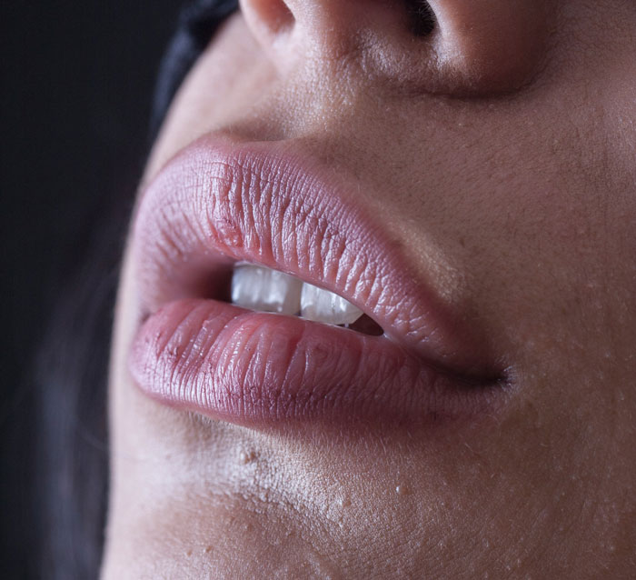 Close-up of lips with natural makeup, highlighting a debated fashion trend.