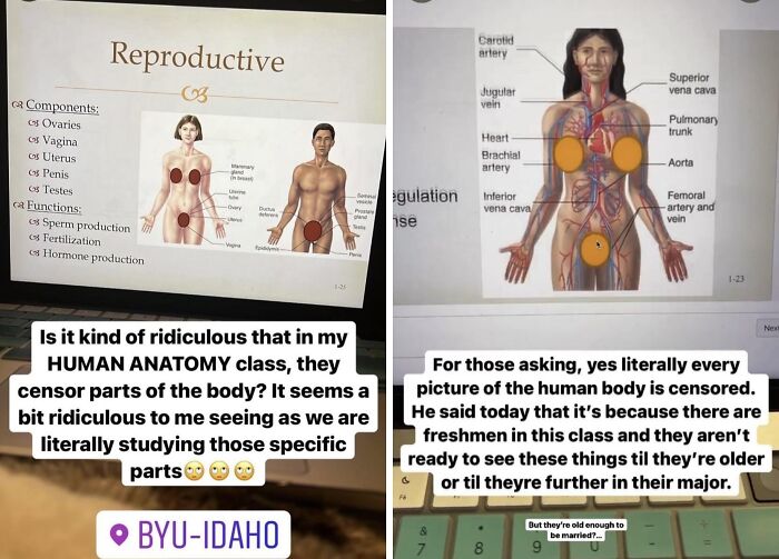 BYU-Idaho human anatomy slides with censored body diagrams, illustrating a unique school experience.