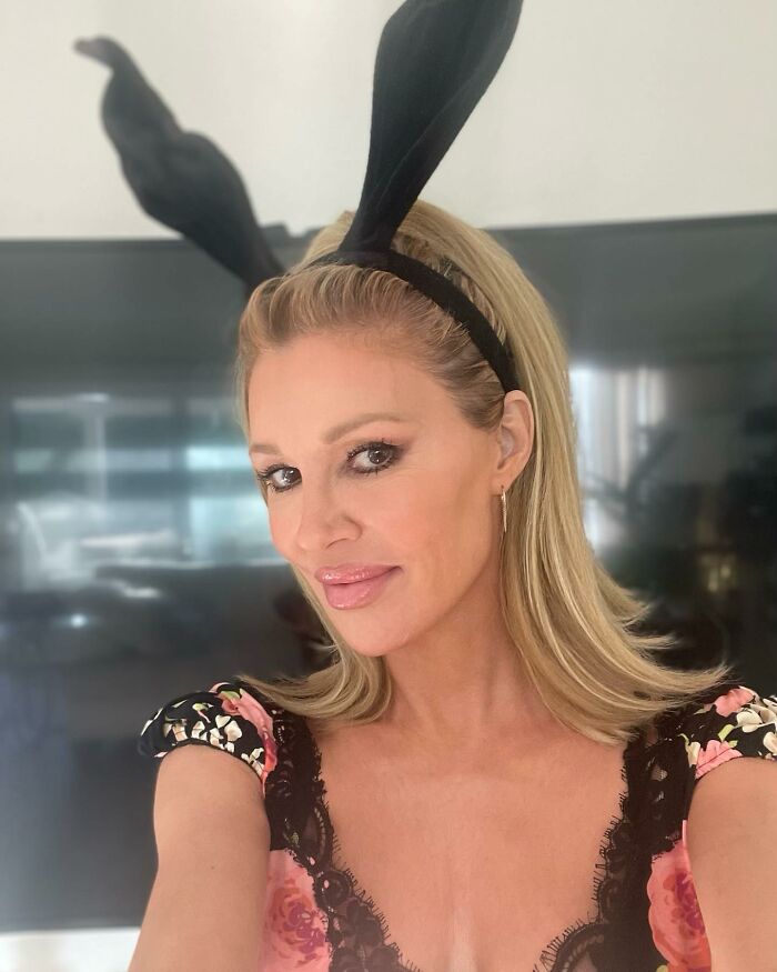 Swollen-Faced Brandi Glanville Says She Can Feel The &ldquo;Parasite&rdquo; Having &ldquo;Babies In [Her] Face&rdquo;