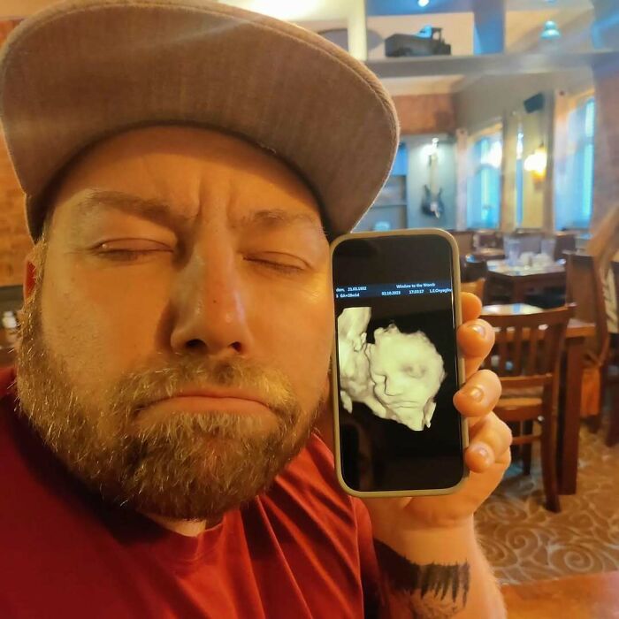 Man humorously mimicking a baby ultrasound image on his phone, capturing a funny pregnancy situation.
