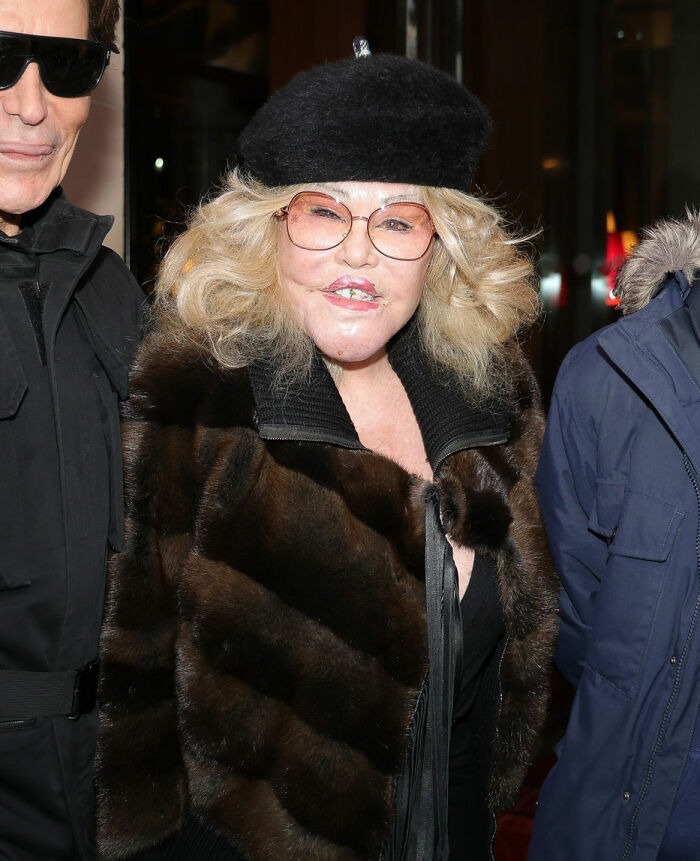 &ldquo;Jocelyn Wildenstein in Paris wearing a fur coat and beret, with her fianc&eacute;, highlighting smooth skin.&rdquo;