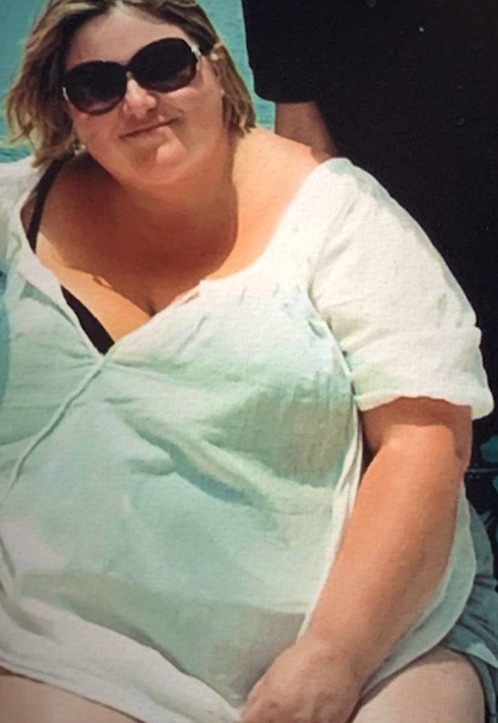 “Exercise Was A No-Go”: Mom Shares Weight-Loss Journey That Made Her Shed Half Her Body Weight “Exercise Was A No-Go”: Mom Shares Weight-Loss Journey That Made Her Shed Half Her Body Weight