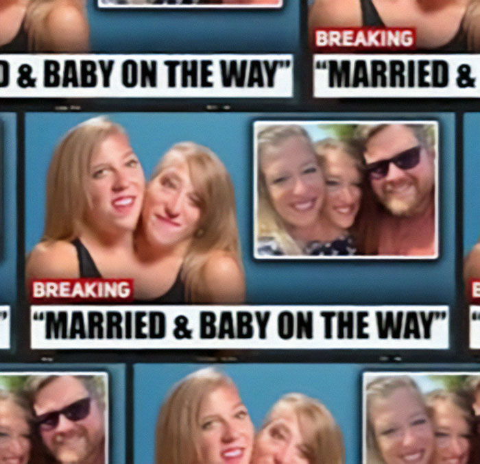 Speculation Surrounds Abby and Brittany Hensel After Unusual Video Emerges