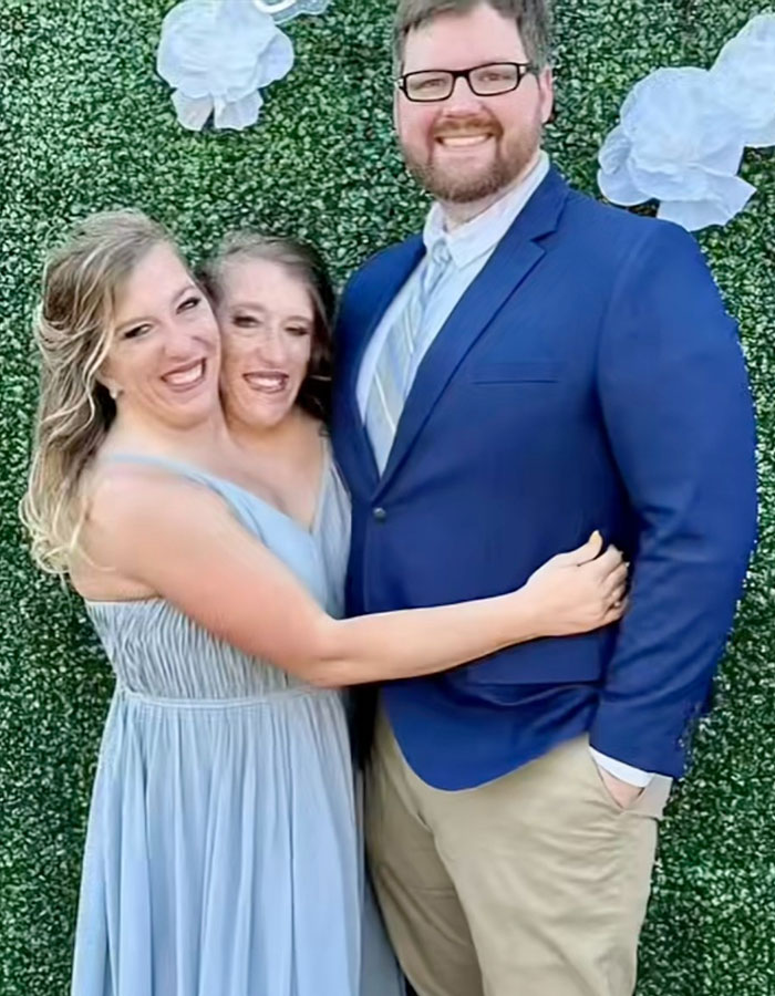 Speculation Surrounds Abby and Brittany Hensel After Unusual Video Emerges