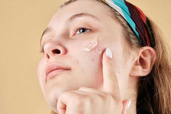 Teen applying cream on face, highlighting use without permission and resulting chemical burns. Teen applying cream on face, highlighting use without permission and resulting chemical burns.