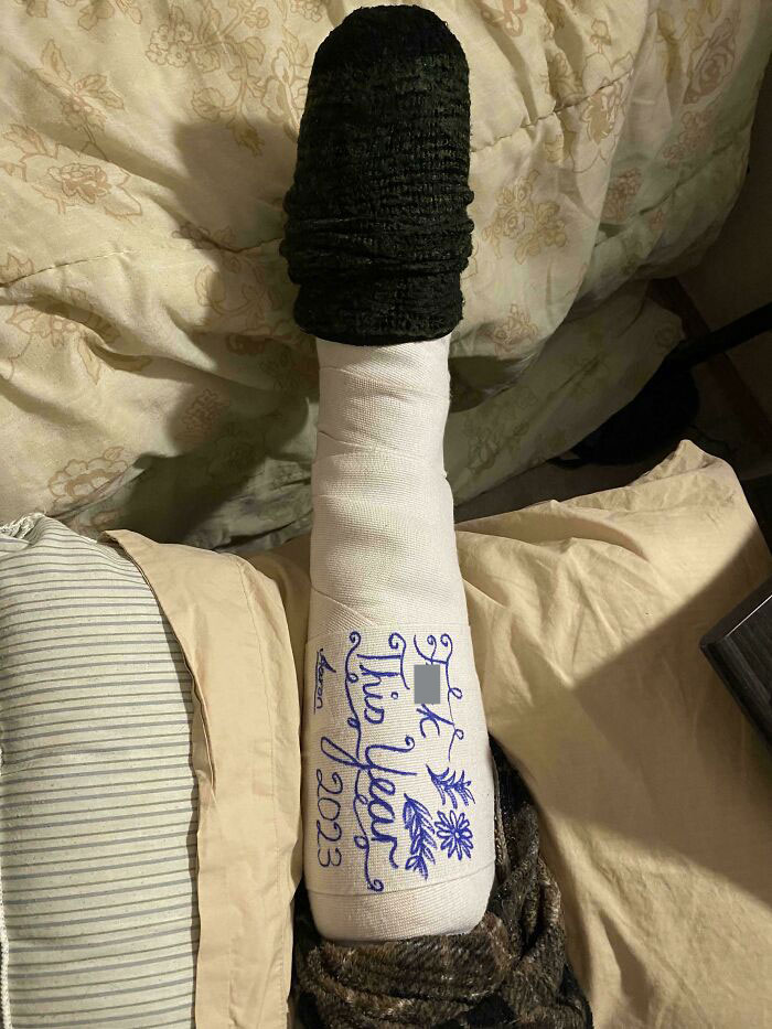 Christmas accident with a leg in a cast, featuring handwritten text and drawings, resting on a bed.