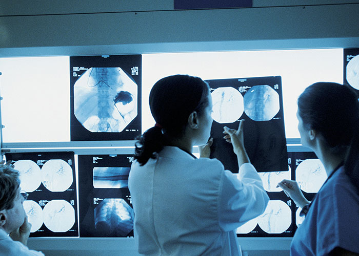 Hospital workers examining x-rays on a lightbox, discussing medical insights in a hospital setting.