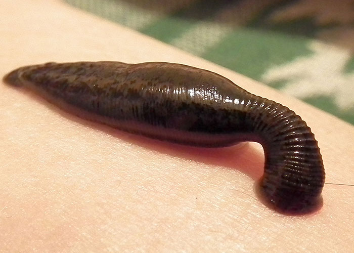 Leech on skin, related to hospital workers' wild stories, resembling a scene from a movie.