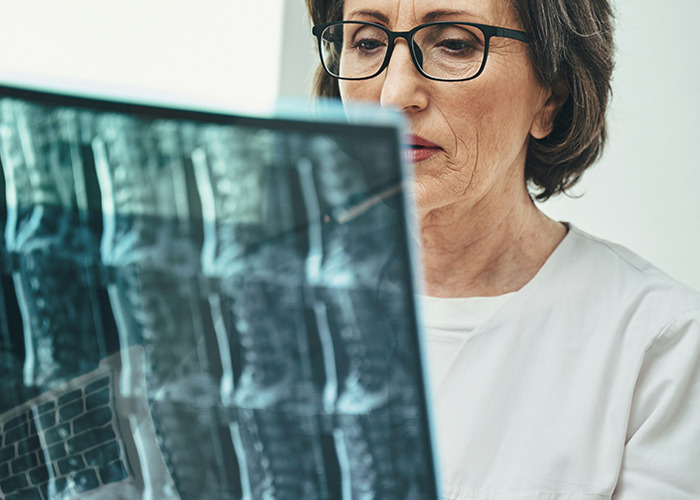 An older woman reviewing X-ray results, contemplating possible insurance outcomes.