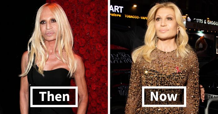 20 Stars Whose Dramatic Transformations Had Everyone Talking This Year