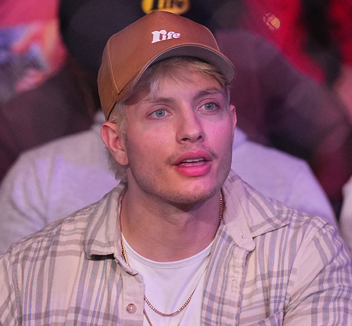 Matt Rife in a plaid shirt and cap reacting to plastic surgery rumors, with a surprised expression.