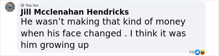 Comment reacting to Matt Rife's look and plastic surgery rumors, discussing his facial changes.