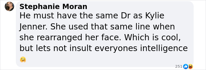 Comment discussing Matt Rife and plastic surgery rumors in a playful tone.