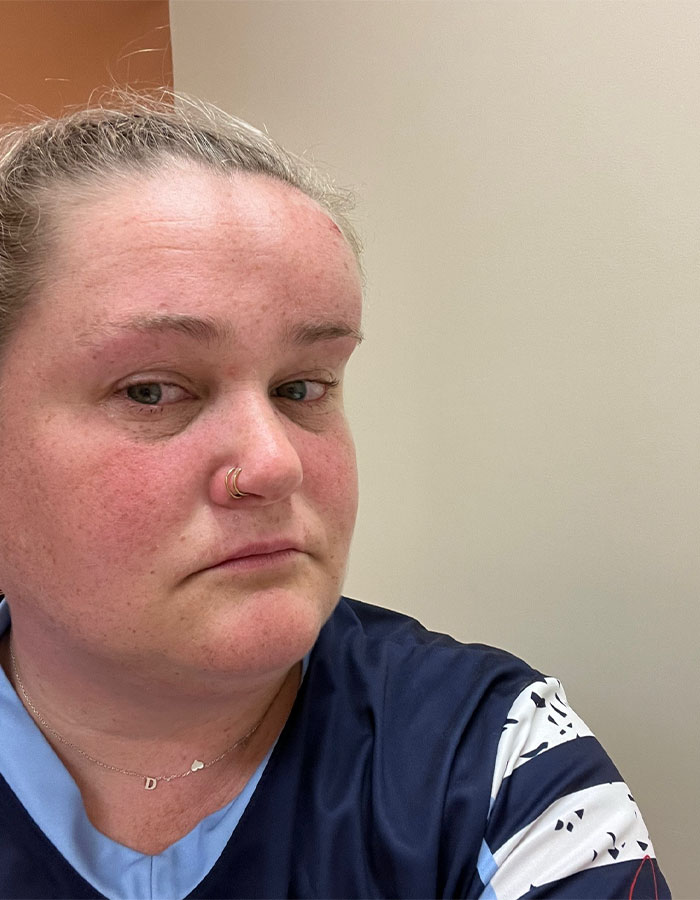 Netizens Say Makeup Artist &ldquo;Nailed It&rdquo; After Hiding Bride&rsquo;s Facial Bruise 5 Days Before Wedding