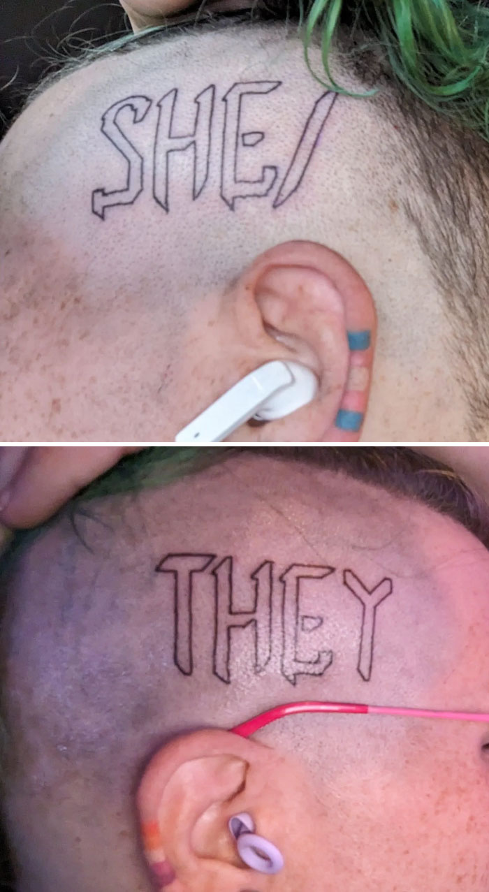 At Least The Hair Will Grow And Cover It?