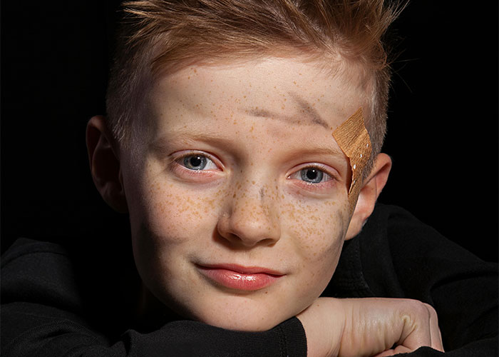 Child with a band-aid on forehead, smiling, embodying a hilarious Thanksgiving mishap.