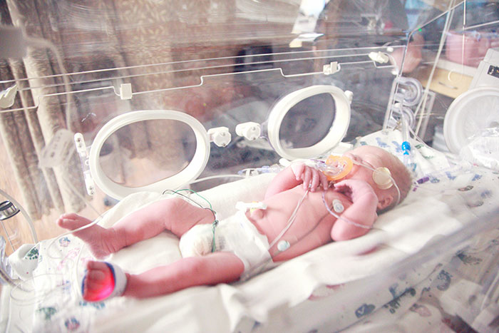 Newborn in an incubator at a maternity ward, wearing a diaper and monitoring devices.