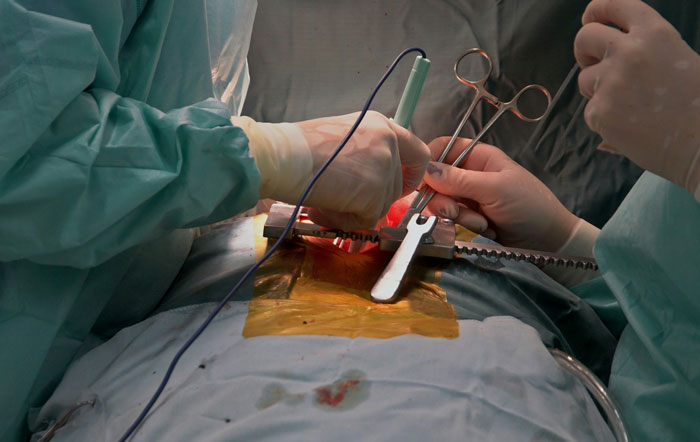 Surgeons performing an operation, illustrating a life-saving sacrifice in progress.