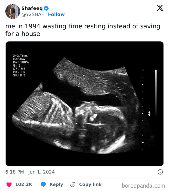 Ultrasound image with text about millennials resting in 1994 instead of saving for a house, highlighting relatable humor.