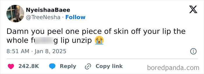 Funny tweet about accidentally peeling skin off your lip, highlighting a relatable struggle.
