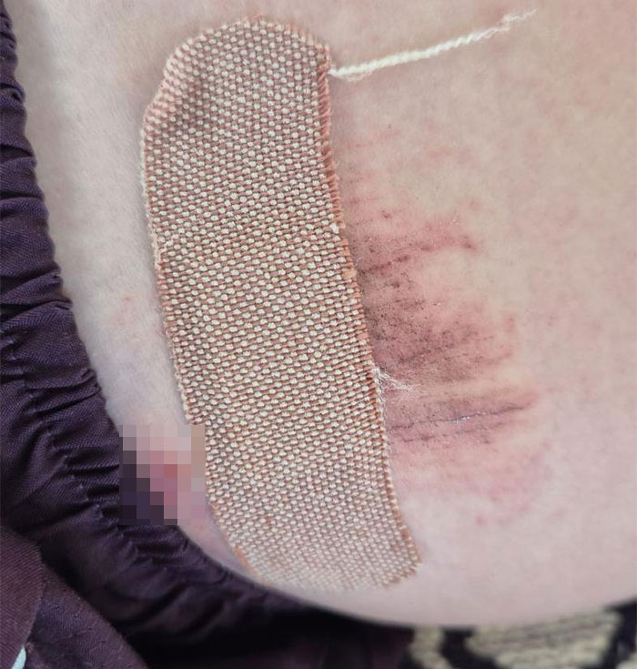 "Male Karens In The Wild": White Man Hits 12YO With Car, Police Say He Was "Racially Abused"