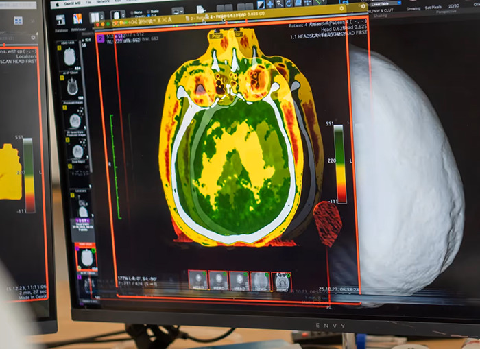 Medical imaging on monitor illustrating body freezing technique for future revival.