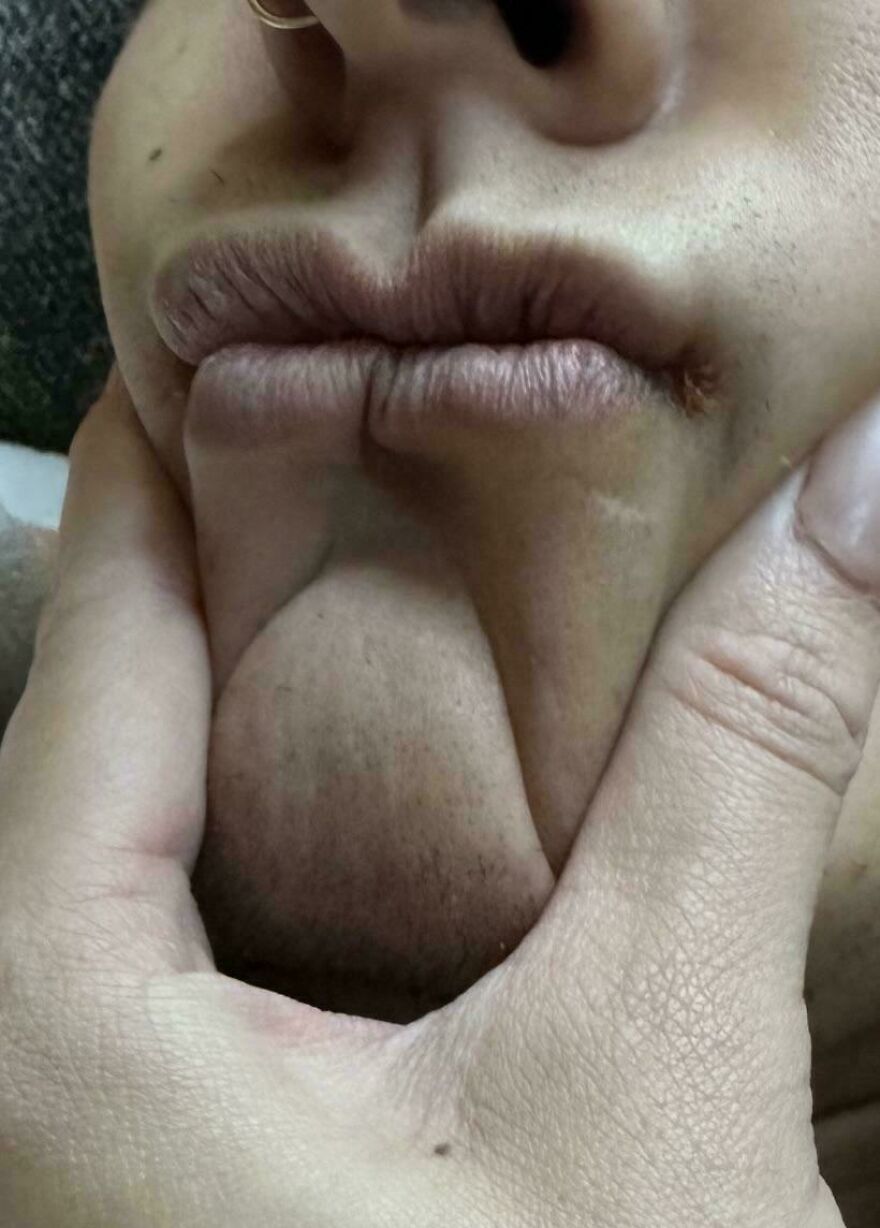 Close-up of a chin appearing like lips, demonstrating the concept of things looking like other things.