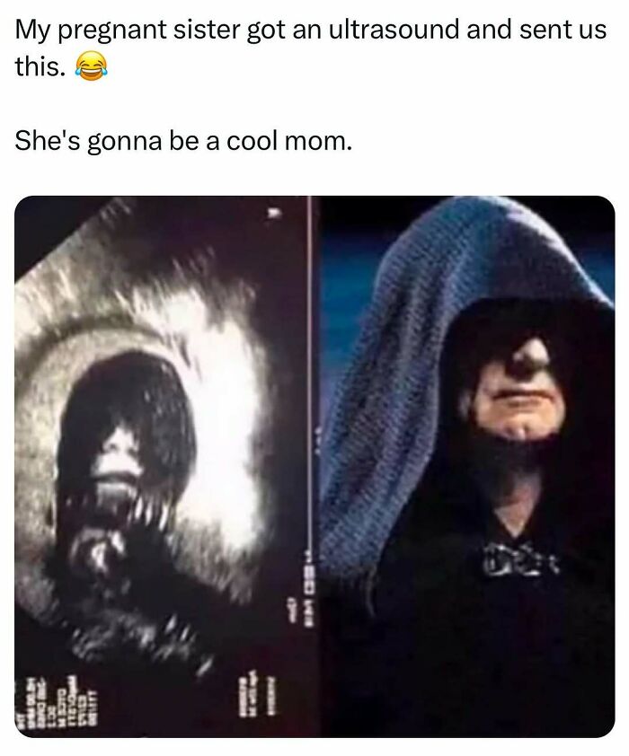 Ultrasound image humorously compared to a movie villain, highlighting relatable memes for men.