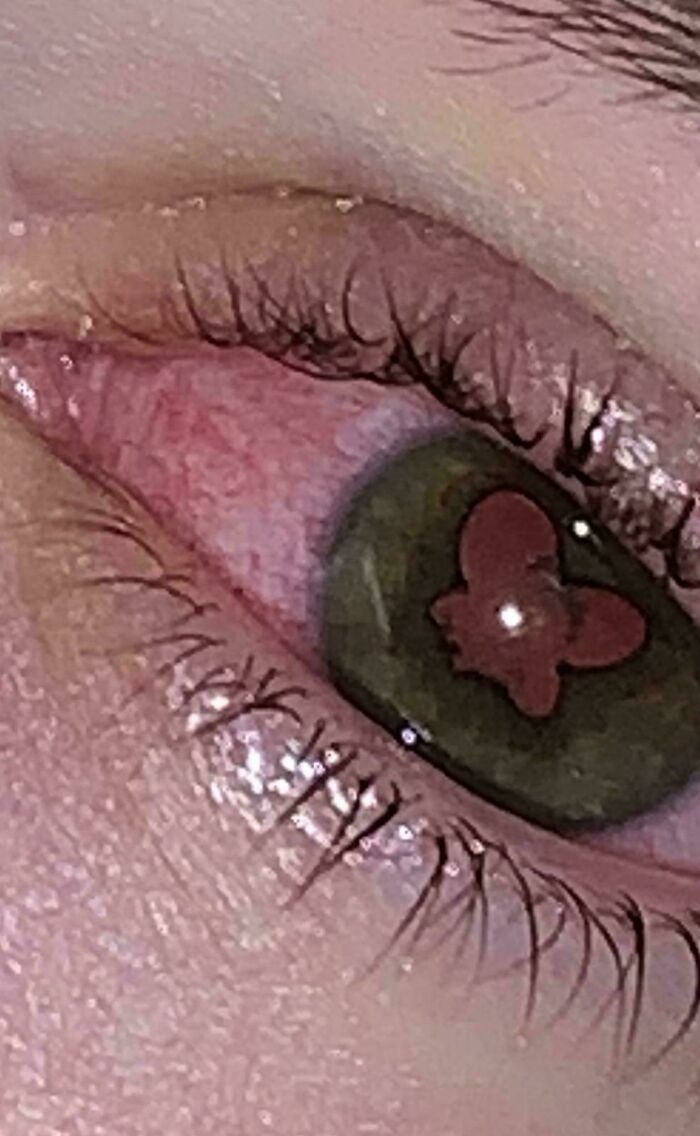 Close-up of an eye with a butterfly-shaped reflection, offering mildly interesting visual detail.
