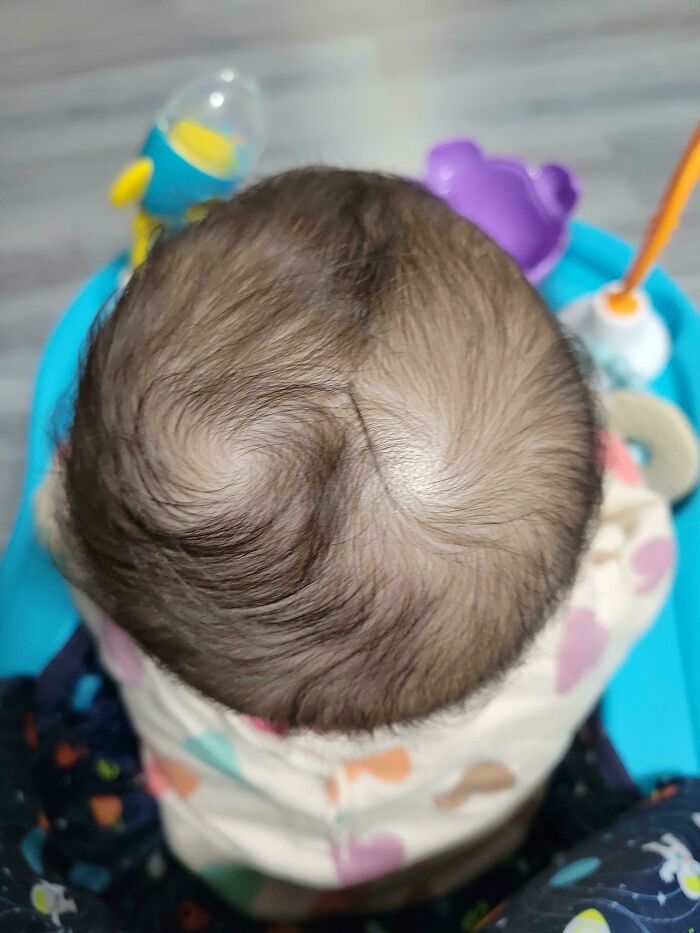 Baby's head with a unique hair swirl pattern, offering mildly interesting visual amusement.